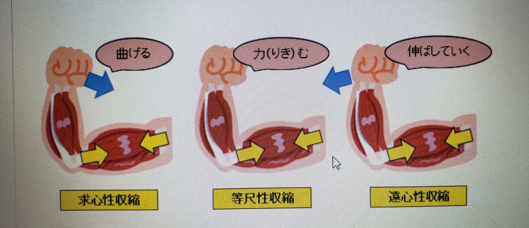 膝折れはなぜ起きるのか？！ 東大和市リハビリデイサービス「コスモス」